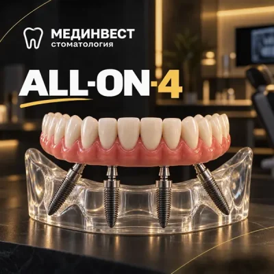 имплантация Мединвест all_an_4 все на 4
